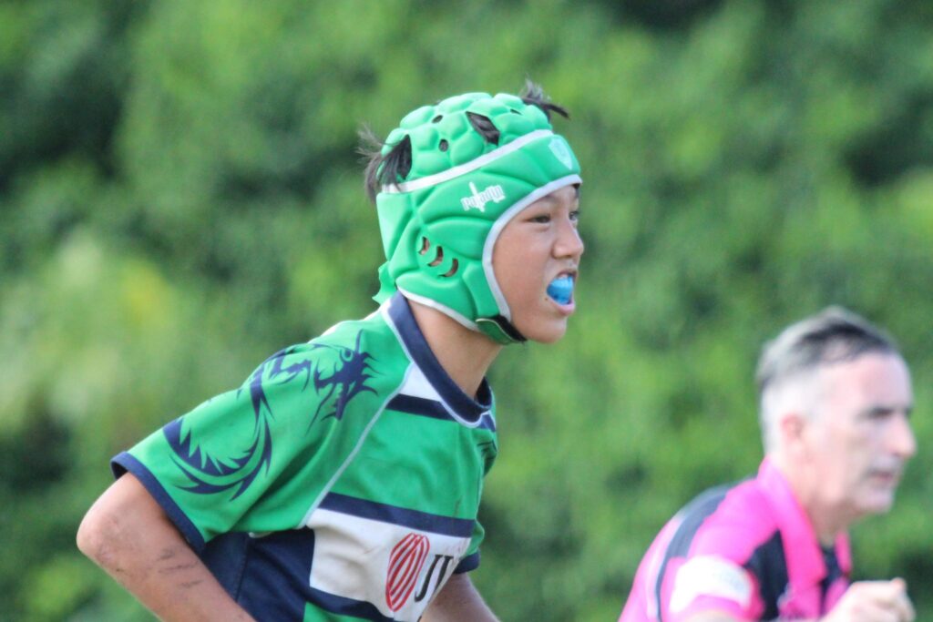 Can You Play Rugby With Braces?
